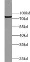 Ubiquitin Specific Peptidase 44 antibody, FNab09334, FineTest, Western Blot image 