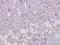 Docking Protein 1 antibody, A03039-2, Boster Biological Technology, Immunohistochemistry paraffin image 