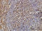 Thiopurine S-Methyltransferase antibody, LS-C133493, Lifespan Biosciences, Immunohistochemistry paraffin image 