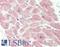 Activin A Receptor Type 2B antibody, LS-B11932, Lifespan Biosciences, Immunohistochemistry paraffin image 