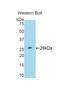 C-Reactive Protein antibody, LS-C297704, Lifespan Biosciences, Western Blot image 
