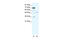 Cholinergic Receptor Nicotinic Alpha 3 Subunit antibody, 31-101, ProSci, Western Blot image 