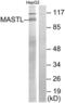 Greatwall protein kinase antibody, LS-C119208, Lifespan Biosciences, Western Blot image 