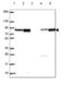 DM1 Locus, WD Repeat Containing antibody, NBP2-49548, Novus Biologicals, Western Blot image 