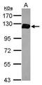 Drebrin 1 antibody, PA5-34725, Invitrogen Antibodies, Western Blot image 