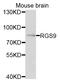 Regulator Of G Protein Signaling 9 antibody, STJ111658, St John