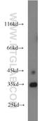 Nucleoporin 35 antibody, 19819-1-AP, Proteintech Group, Western Blot image 