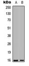 Galectin 7B antibody, LS-C368394, Lifespan Biosciences, Western Blot image 