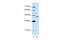 Zinc Finger Protein 396 antibody, 29-145, ProSci, Enzyme Linked Immunosorbent Assay image 