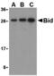 BH3 Interacting Domain Death Agonist antibody, A00730-1, Boster Biological Technology, Western Blot image 