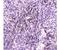 He1 antibody, LS-C662939, Lifespan Biosciences, Immunohistochemistry paraffin image 