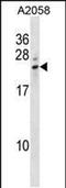 Lipocalin 8 antibody, PA5-48792, Invitrogen Antibodies, Western Blot image 