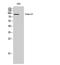 DEAD-Box Helicase 20 antibody, A05291, Boster Biological Technology, Western Blot image 