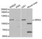 Glutamate Ionotropic Receptor Kainate Type Subunit 2 antibody, MBS127955, MyBioSource, Western Blot image 