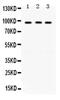 Histone acetyltransferase GCN5 antibody, PA5-79548, Invitrogen Antibodies, Western Blot image 