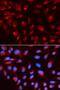 Bars antibody, LS-C331649, Lifespan Biosciences, Immunofluorescence image 