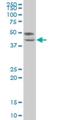 Transcription Factor 7 antibody, H00006932-M02, Novus Biologicals, Western Blot image 