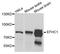EF-Hand Domain Containing 1 antibody, A8002, ABclonal Technology, Western Blot image 