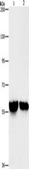 Aldehyde Dehydrogenase 8 Family Member A1 antibody, TA349460, Origene, Western Blot image 