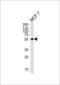 Aldehyde Dehydrogenase 6 Family Member A1 antibody, LS-C156268, Lifespan Biosciences, Western Blot image 