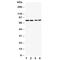 Melanoma Cell Adhesion Molecule antibody, R30826, NSJ Bioreagents, Western Blot image 