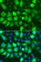 Ribonucleotide Reductase Regulatory Subunit M2 antibody, GTX33480, GeneTex, Immunofluorescence image 