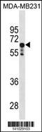 Serine/threonine-protein phosphatase 2A 65 kDa regulatory subunit A alpha isoform antibody, 60-680, ProSci, Western Blot image 