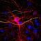 Neurofilament Light antibody, ab134460, Abcam, Immunocytochemistry image 