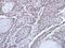 FA Complementation Group D2 antibody, PA5-30592, Invitrogen Antibodies, Immunohistochemistry frozen image 