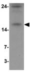 Basic Leucine Zipper ATF-Like Transcription Factor antibody, GTX31865, GeneTex, Western Blot image 