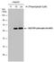 Sequestosome 1 antibody, PA5-78267, Invitrogen Antibodies, Western Blot image 