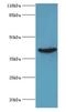 Adenosine Deaminase antibody, LS-C369171, Lifespan Biosciences, Western Blot image 
