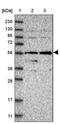 DENN Domain Containing 6B antibody, PA5-54484, Invitrogen Antibodies, Western Blot image 