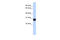 Transcription Elongation Factor A Like 4 antibody, 26-514, ProSci, Enzyme Linked Immunosorbent Assay image 