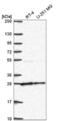 Nudix Hydrolase 21 antibody, NBP2-57491, Novus Biologicals, Western Blot image 