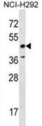 RAD52 Homolog, DNA Repair Protein antibody, abx028842, Abbexa, Western Blot image 