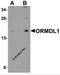 ORMDL Sphingolipid Biosynthesis Regulator 1 antibody, 6313, ProSci, Western Blot image 