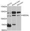NEDD4 Like E3 Ubiquitin Protein Ligase antibody, orb373946, Biorbyt, Western Blot image 