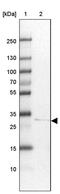 Hydroxysteroid 17-Beta Dehydrogenase 11 antibody, PA5-54469, Invitrogen Antibodies, Western Blot image 