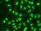 Replication Factor C Subunit 1 antibody, orb48524, Biorbyt, Immunocytochemistry image 