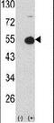 Protein Kinase CAMP-Dependent Type I Regulatory Subunit Alpha antibody, PA5-15368, Invitrogen Antibodies, Western Blot image 