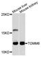 Translocase Of Outer Mitochondrial Membrane 6 antibody, STJ27211, St John