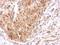 Epidermal Growth Factor Receptor Pathway Substrate 8 antibody, LS-C185353, Lifespan Biosciences, Immunohistochemistry paraffin image 