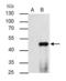 Peroxisome Proliferator Activated Receptor Alpha antibody, GTX101098, GeneTex, Immunoprecipitation image 