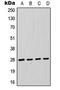 Fas Associated Via Death Domain antibody, LS-C354129, Lifespan Biosciences, Western Blot image 