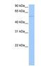 Chimerin 1 antibody, NBP1-58326, Novus Biologicals, Western Blot image 