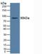 Insulin Receptor antibody, LS-C294674, Lifespan Biosciences, Western Blot image 