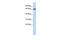 UDP Glucuronosyltransferase Family 2 Member B15 antibody, GTX47096, GeneTex, Western Blot image 