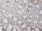 Nuclear Factor Kappa B Subunit 1 antibody, LS-C133345, Lifespan Biosciences, Immunohistochemistry paraffin image 