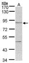 Thimet Oligopeptidase 1 antibody, GTX104000, GeneTex, Western Blot image 